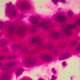 Illustration for article titled Report: HPV Tests Can Replace Pap Smears For Cervical Cancer Screenings in the Over-30 Crowd